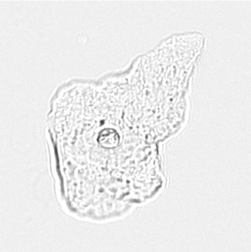 Эпителий плоский