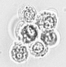 Скопления лейкоцитов