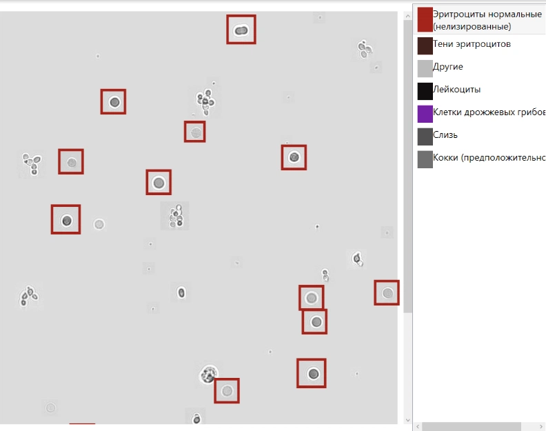 Гистограммы морфологии эритроцитов